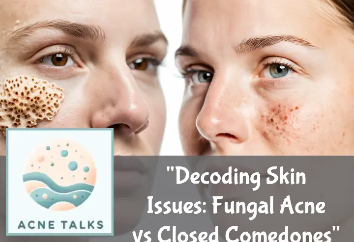 Decoding Skin Issues: Fungal Acne vs Closed Comedones